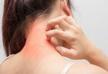 De meest voorkomende oorzaken van allergische reacties Allergische reacties