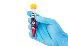 legionella