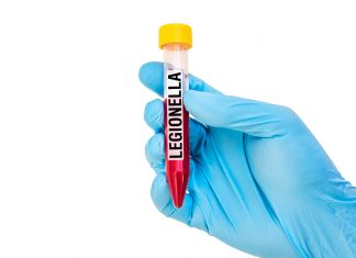 legionella